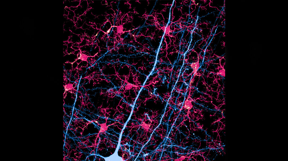 Benzo.jpg Fortsätze einer Nervenzelle (blau) und Mikroglia (rot)