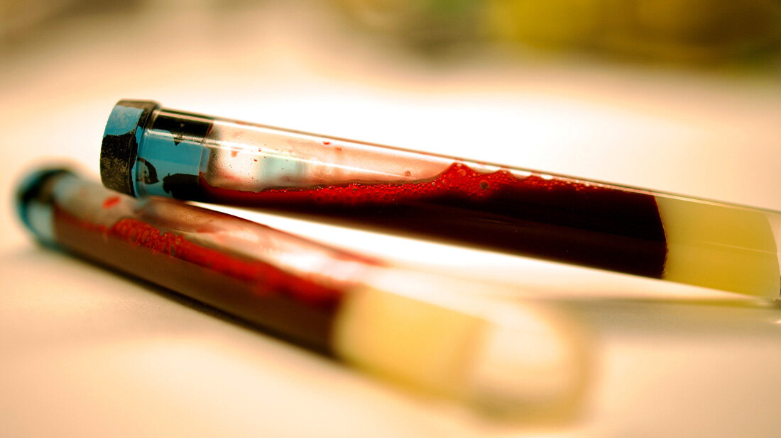 Blut_fuer_Tests.jpg Zwei gefüllte Blutröhrchen liegen auf einem Tisch.