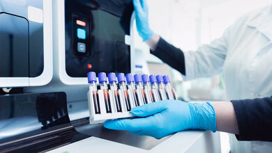 Symbolbild medizinisches Labor