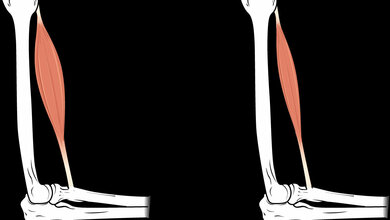 Muskelatrophie_OpenStax_CC_BY_4.0.jpg Muskelatrophie