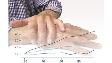 Parkinson_Krankheit.jpg Parkinson-Krankheit