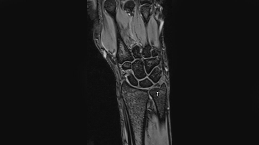 Titelbild zum Fachbeitrag zu Längenvarianten der Ulna