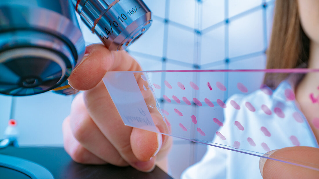 Bilden Sie sich weiter in der Histologie Titelbild des Beitrags über Weiterbildungsangebote des DIW-MTA im Bereich Histologie