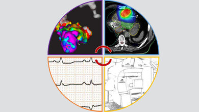 Übersicht über die STAR als interdisziplinäre Behandlung von Kardiologie und Strahlentherapie.