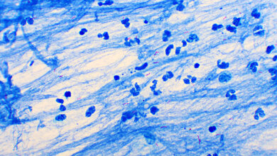 Mycobacterium tuberculosis