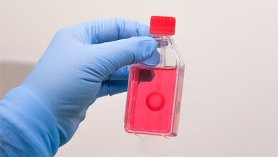 Hornhauttransplantat in der Gewebebank