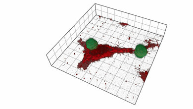 Konfokalmikroskopische Aufnahme von NK-Zellen (grün) und Melanomzellen (rot)