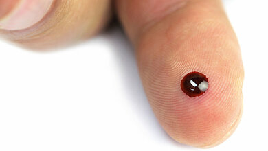 Point-of-Care-Testing (POCT) – Patientennahe Sofortdiagnostik