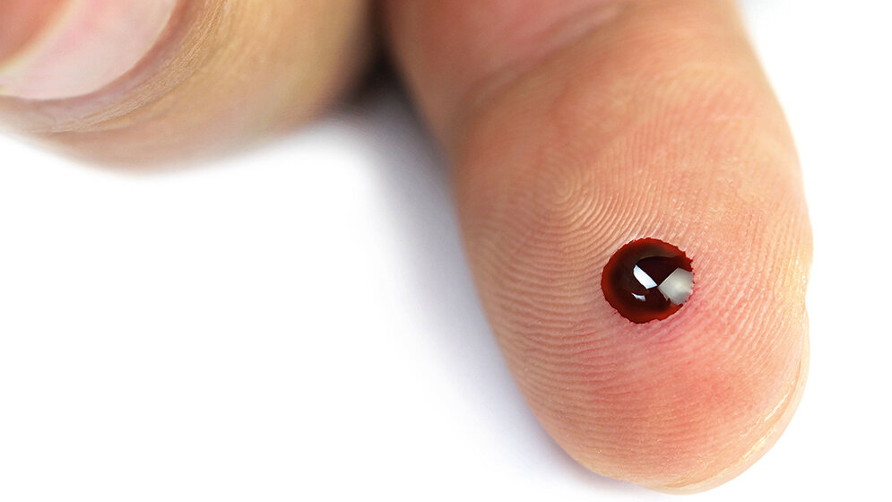 Point-of-Care-Testing (POCT) – Patientennahe Sofortdiagnostik