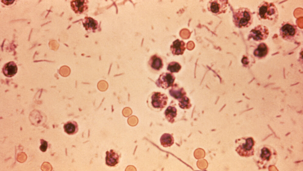 Abb4_Shigellose.jpg 113 epidemische Ausbrüche von Shigellose