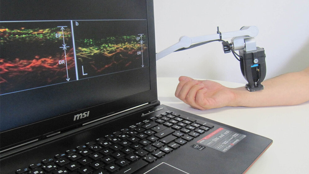 neu entwickelter Gewebescanner 