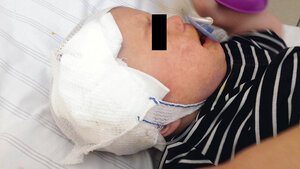 Masernausbrüche in Deutschland