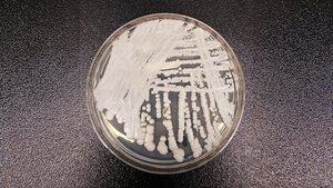 Petrischale mit Candida auris