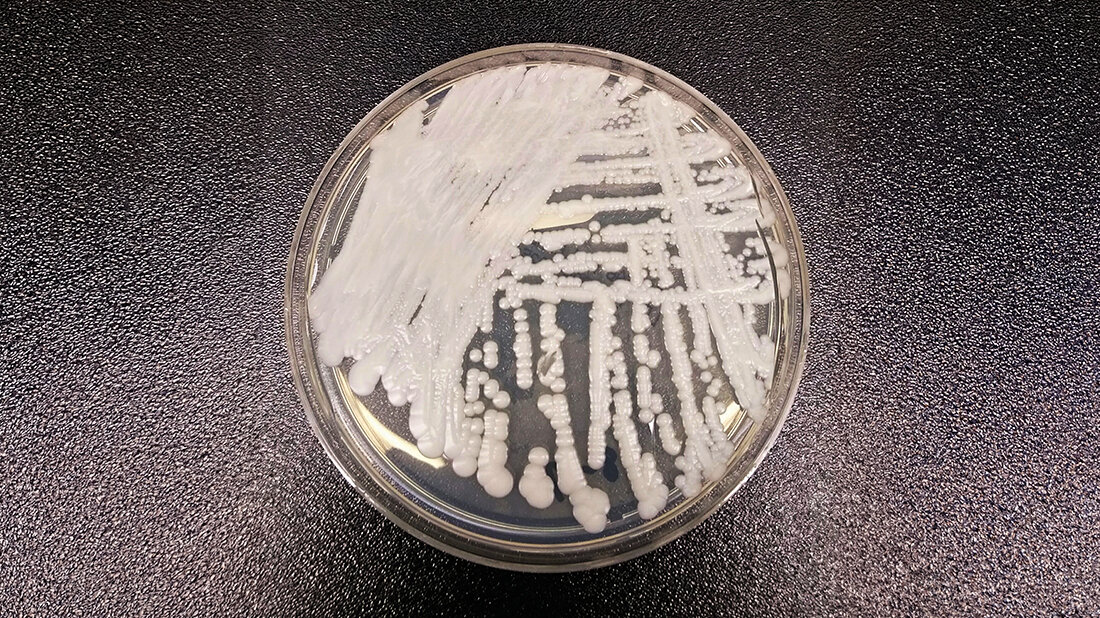 Candida (Candidozyma) auris Petrischale mit Candida auris