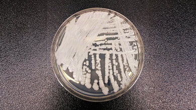 Candida (Candidozyma) auris Petrischale mit Candida auris