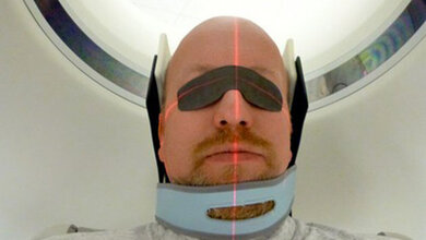 Wege zur Reduktion der Augenlinsendosis bei der Computertomographie des Schädels Strahlenschutz