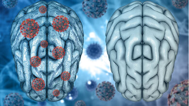 SARS-CoV-2 und Gehirn