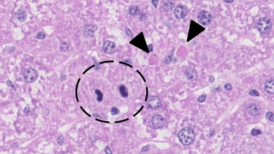 Mcl1_liver_Leberzelle.jpg Apoptose