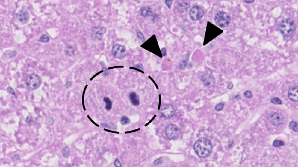 Mcl1_liver_Leberzelle.jpg Apoptose