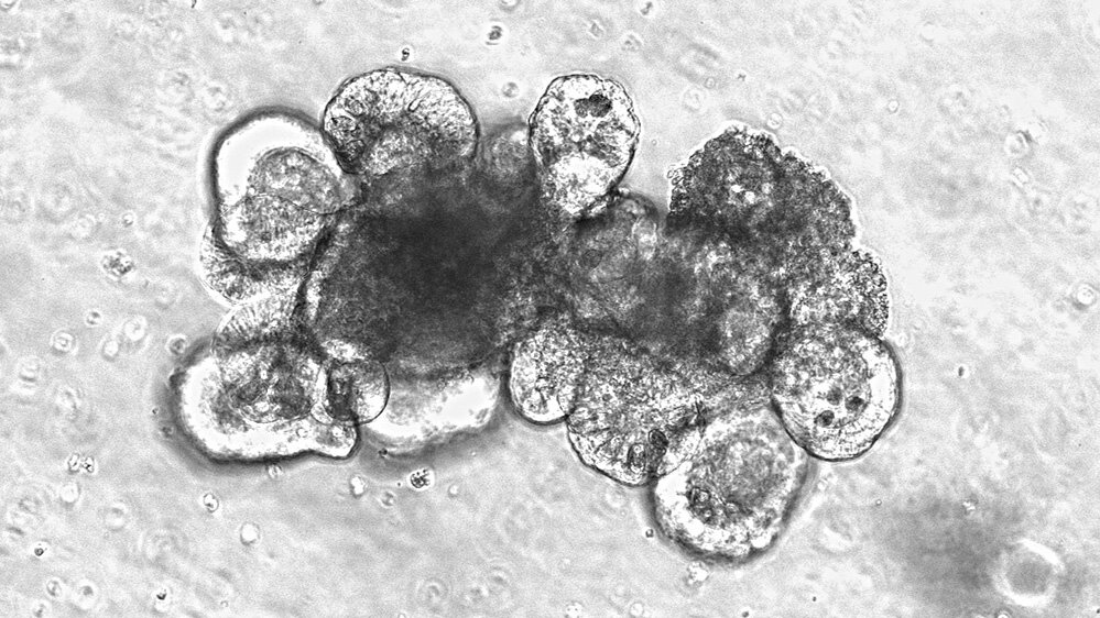 Stammzelle_MiniDarm.jpg Mikroskopische Aufnahme von Zellstrukturen in Graustufen, mit einer zentralen dunklen Ansammlung und umgebenden helleren Zellen.