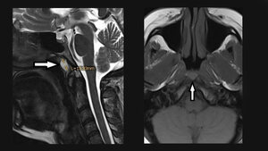 Anomalien und Normvarianten – Veränderungen des Weichgewebes 5.3