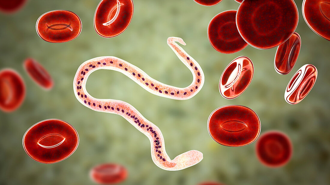 Wuchereria bancrofti