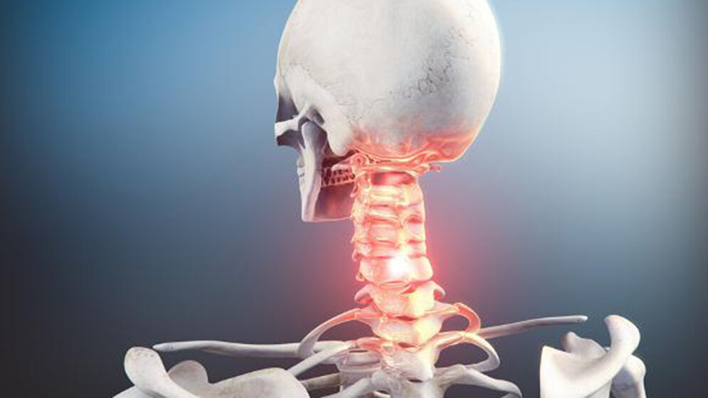 HWS-Instabilität Orthopädie