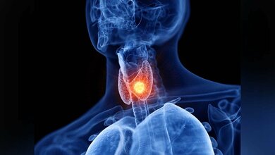 Schilddrüsenkrebs schonender behandeln