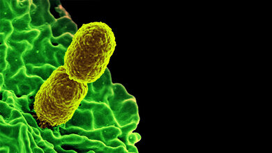 Carbapenem-resistente Klebsiella pneumoniae