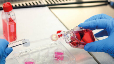 DGFG baut trotz Pandemie Gewebespende weiter aus