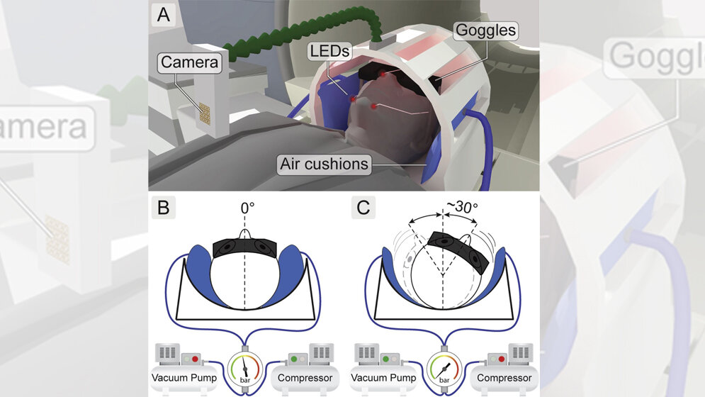 Kopf_des_Probanden_wird_im_fMRT_Scanner_CIN_Universitaet_Tuebingen.jpg Kopf des Probanden im fMRT-Scanner
