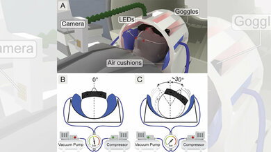 Kopf_des_Probanden_wird_im_fMRT_Scanner_CIN_Universitaet_Tuebingen.jpg Kopf des Probanden im fMRT-Scanner