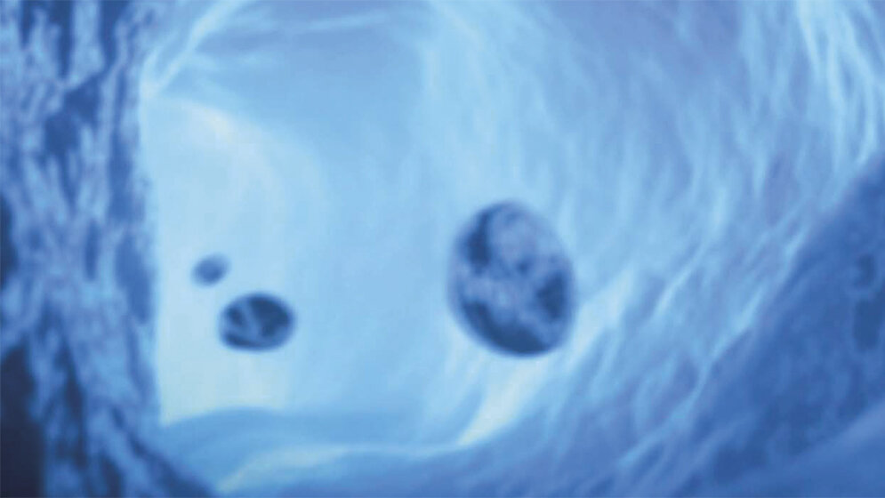 Die diagnostische Bedeutung von C-reaktivem Protein, Procalcitonin und Interleukin–6 bei Sepsisverdacht Labordiagnostik