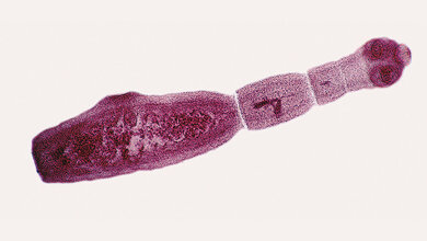 Fuchsbandwurm Sonografie bei Echinokokkose