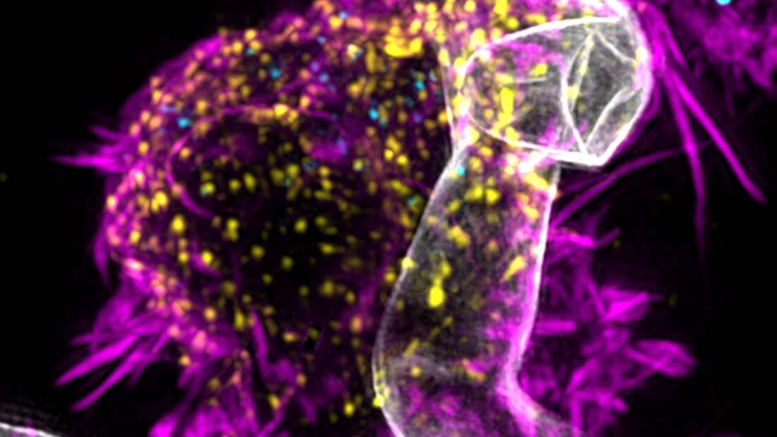 Immuntherapie gegen Schimmelpilz; T-Zellen gentechnisch verändern