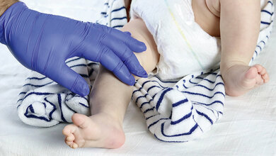 Titelbild des Fachbeitrags mit einem Überblick zur Stoffwechselerkrankung Mukoviszidose