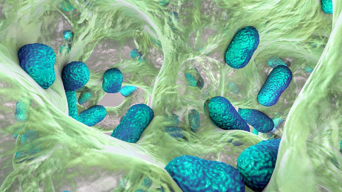 Acinetobacter baumannii 