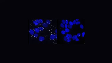 Ankerprotein_G3BP1_Marti_Cadena_Sandoval_UIBK_Innsbruck.jpg Ankerprotein G3BP1