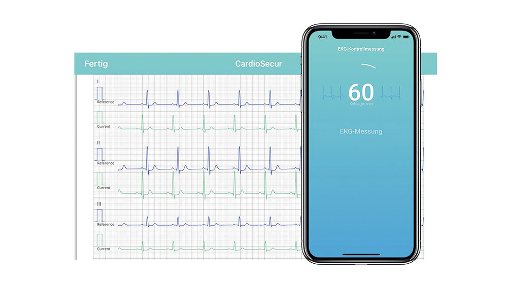 Aus der Industrie CardioSecur EKG