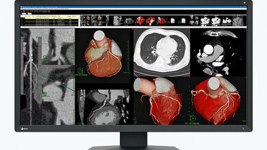 Foto des Monitors RadiForce MX317W von EIZO