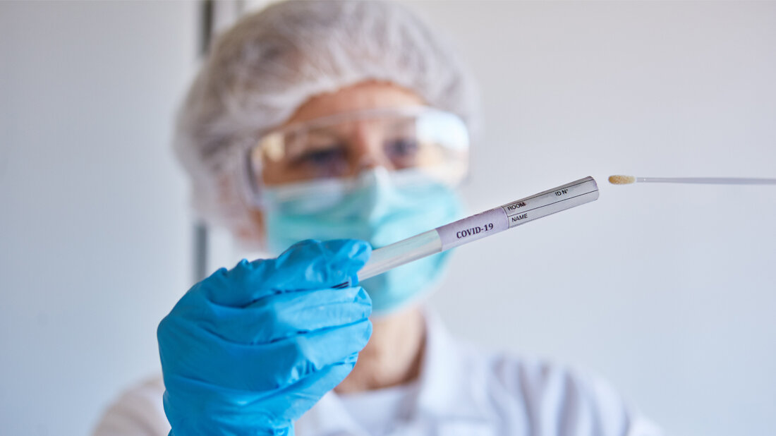 SARS-CoV-2-PCR-Testzahlen