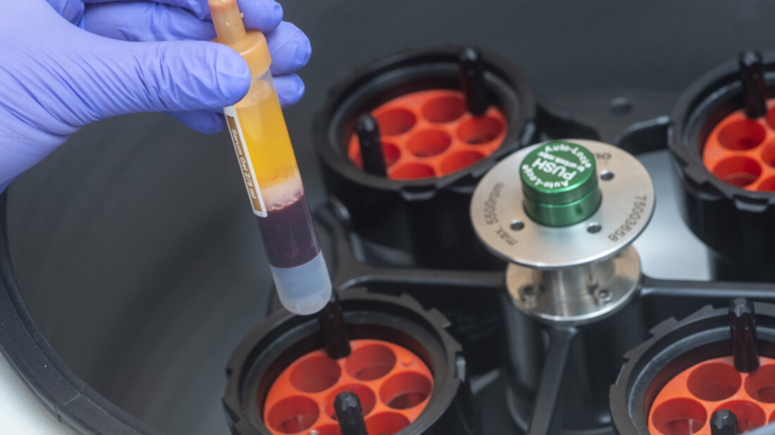 Entzuendungsaltern.jpg Entzündungsaltern stoppen durch richtige Ernährung und Bewegung