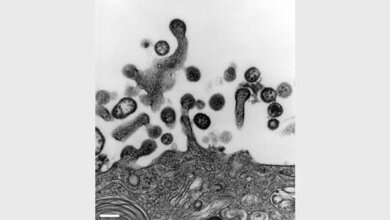 Lymphocytic choriomeningitis virus (Arenaviren)