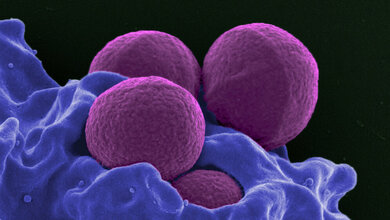 MRSA