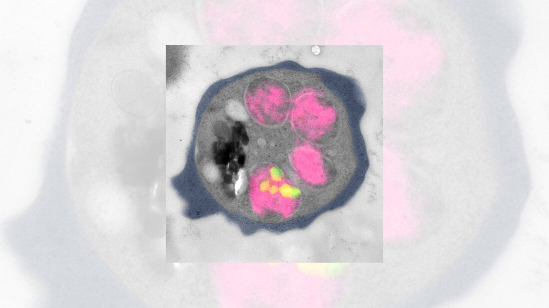 Malaria_Uni_HD.jpg Malariaerreger Plasmodium