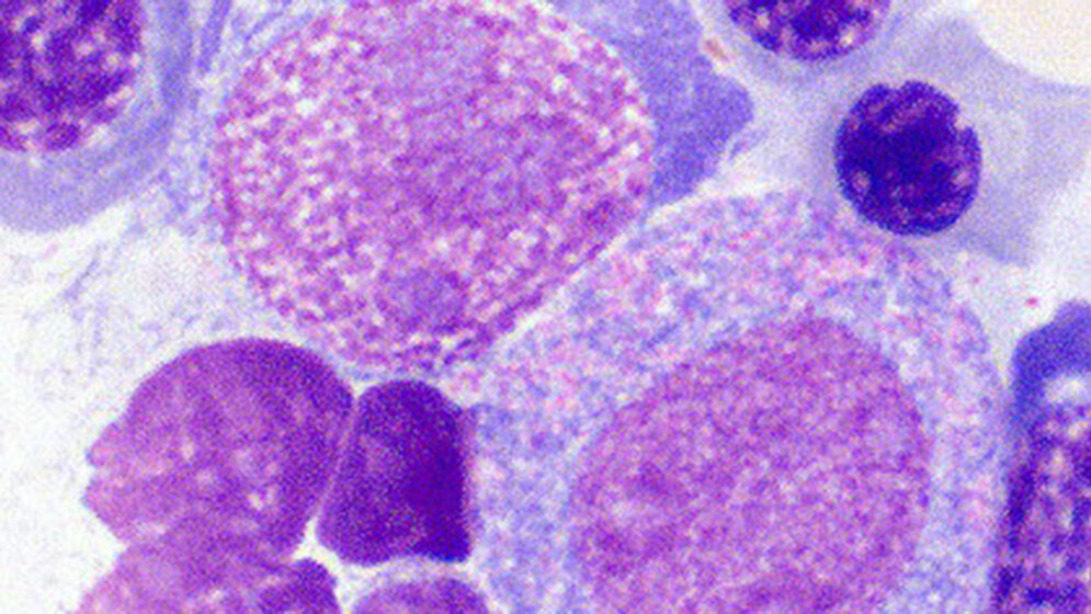 Nukleolen Teil 1: Physiologie