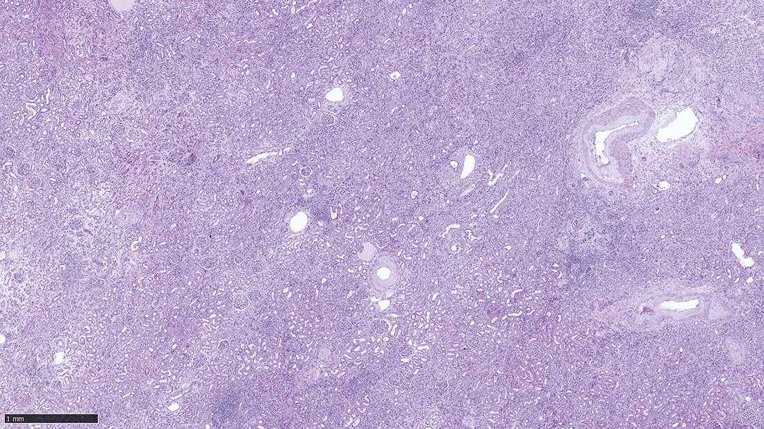 Titelbild zum Fachbeitrag über die Immunhistochemie bei der Differenzialdiagnose von Nierenerkrankungen