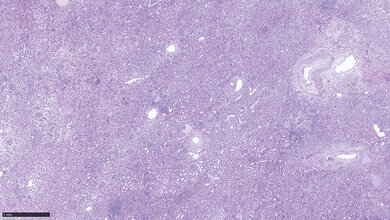 Die Nieren Titelbild zum Fachbeitrag über die Immunhistochemie bei der Differenzialdiagnose von Nierenerkrankungen
