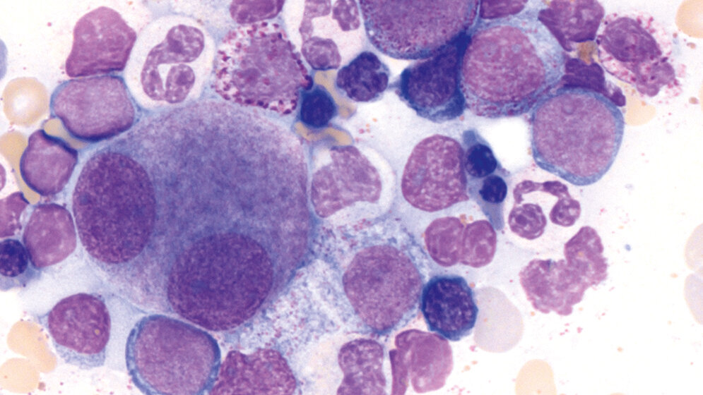 Laboratoriumsmedizin Thrombozytopoese (Teil 5)