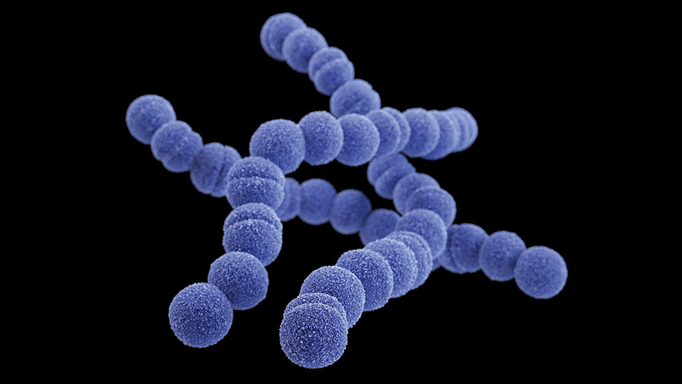 Labordiagnostik Immuno-PCR